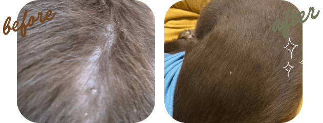 皮膚トラブル 04 before after