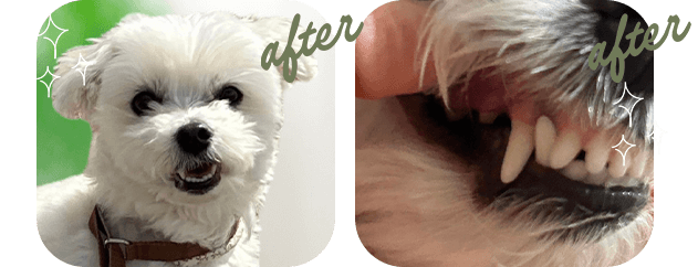 『歯石』 before after